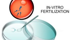 1_In-vitro-fertilization