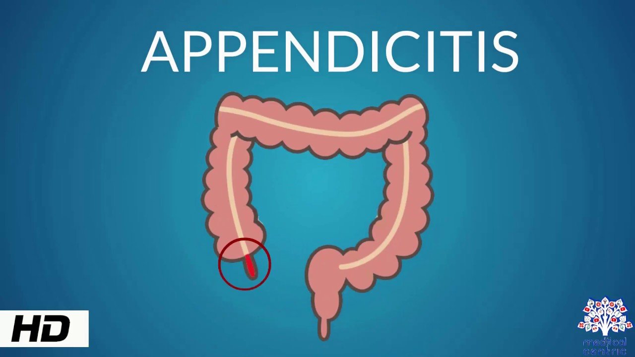 First Aid Spinal Injury Health Video Tips