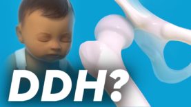 Developmental Dysplasia of Hips (DDH)