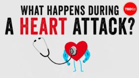 Heart Attack: Understanding the basics