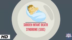 SIDS (Sudden Infant Death Syndrome)
